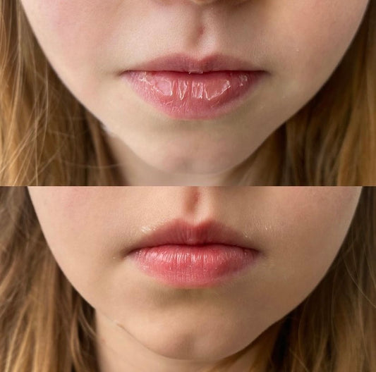 100% NATURAL JUMBO Unscented Lip Balm